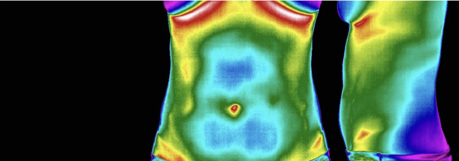 Front and side abdomen thermography images showing surface-temperature patterns