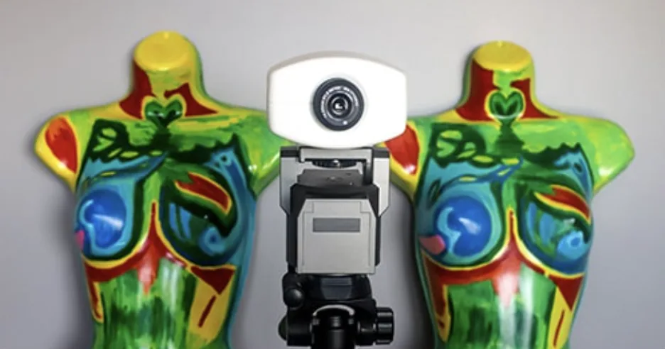 Thermal imaging camera positioned for standardized image capture